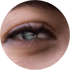 Negative streigth value of the bulge effect